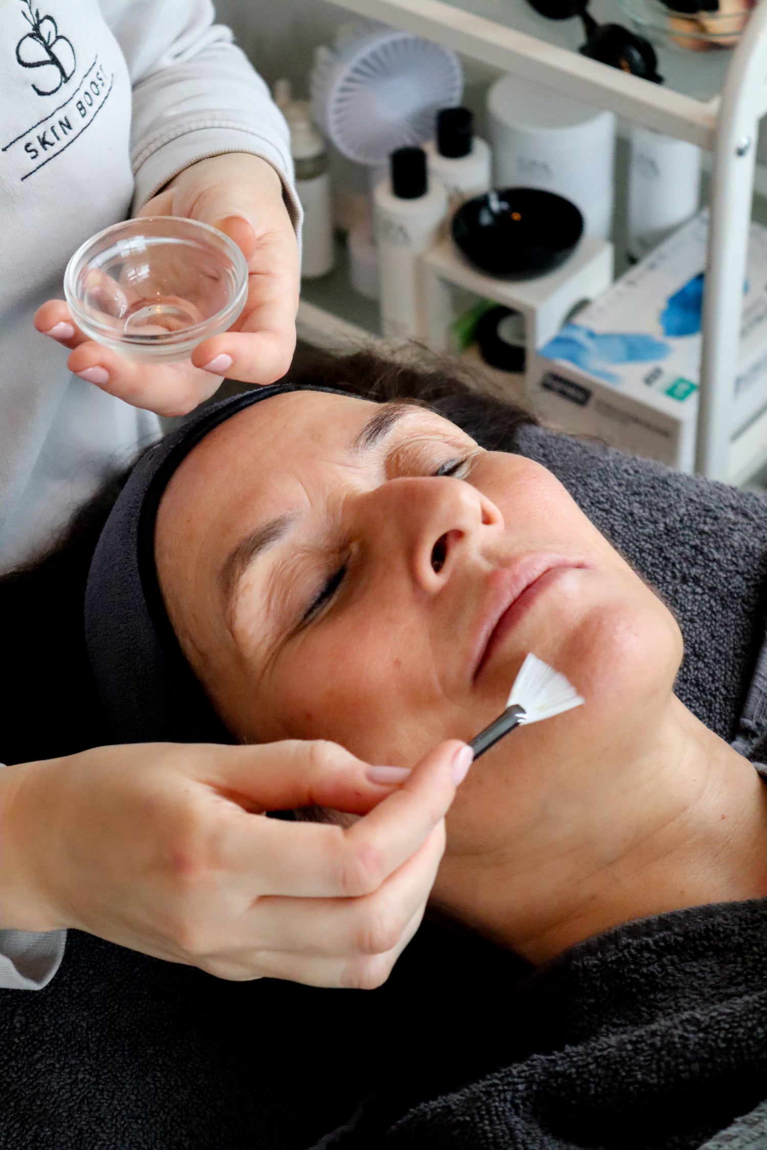 Peeling bij Skin Boost