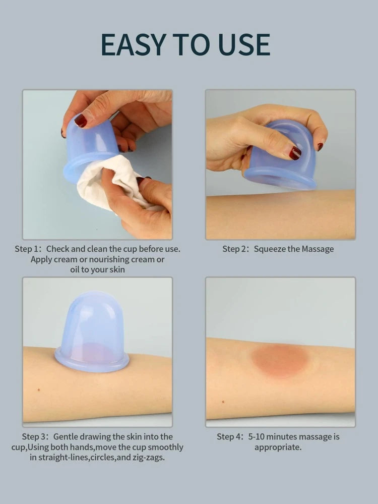 Cupping set