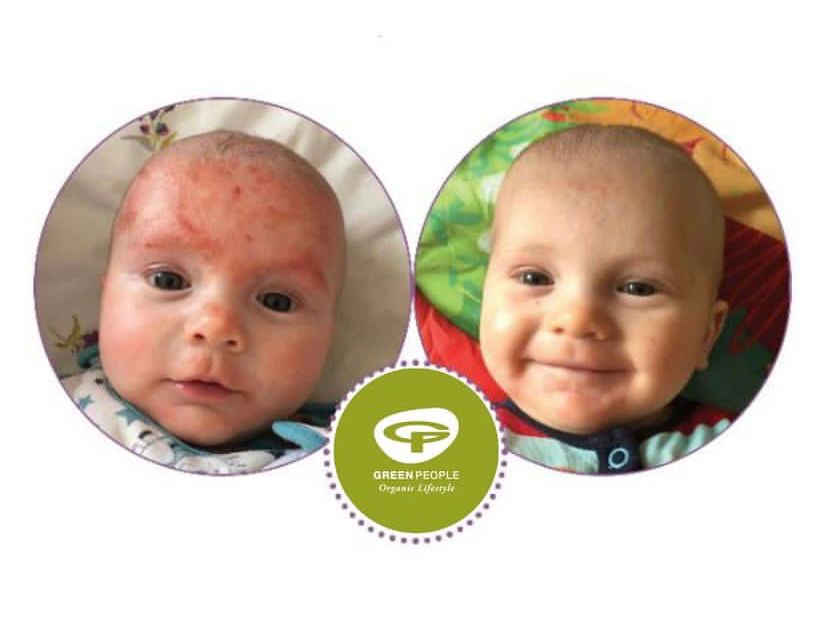 Mum & Baby Rescue Balm