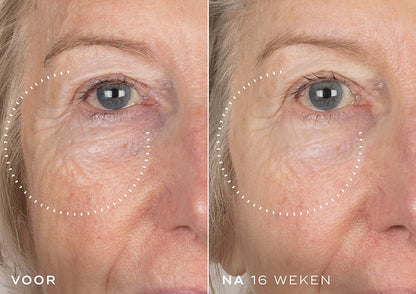 Crystal Retinal Serum